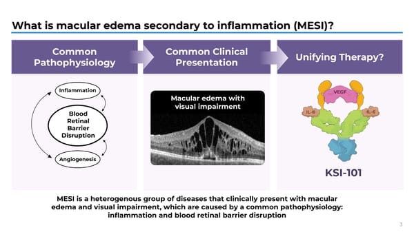 APEX Study Phase 1b Results on KSI-101 for Macular Edema - Page 3