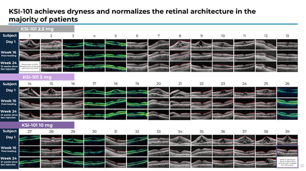 APEX Study Phase 1b Results on KSI-101 for Macular Edema - Page 12